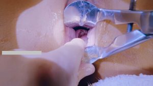 [MP4/80GB]中国拳交女王周晓琳重口味拳交虐阴扩肛80部高清合集（VIP铂金版）
